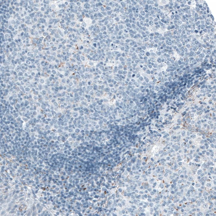 Immunohistochemistry-Paraffin ME3 Antibody - BSA Free