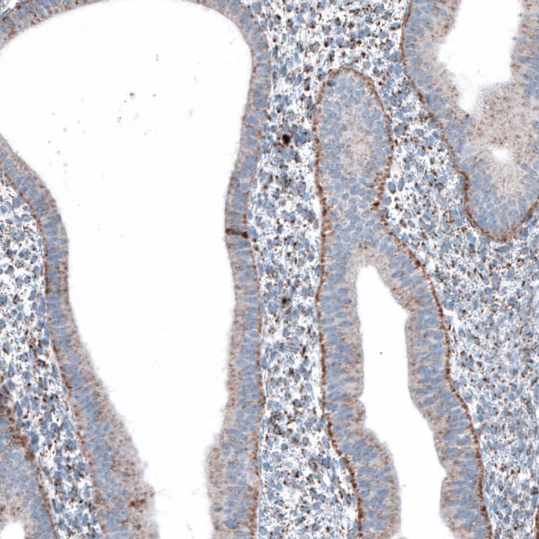 Immunohistochemistry-Paraffin ME3 Antibody - BSA Free