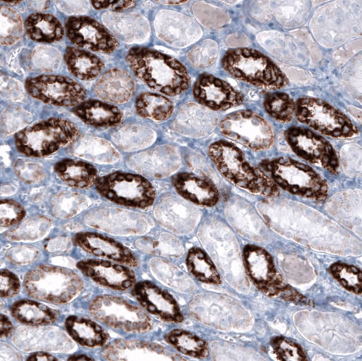 Immunohistochemistry-Paraffin ME3 Antibody - BSA Free