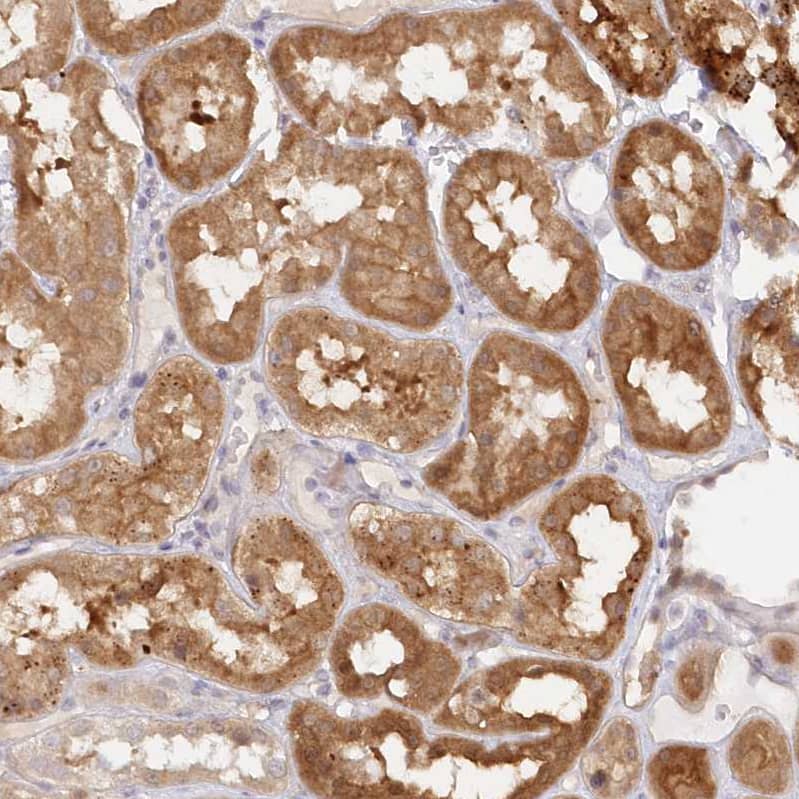 Staining of human kidney shows strong cytoplasmic positivity in cells in tubules.