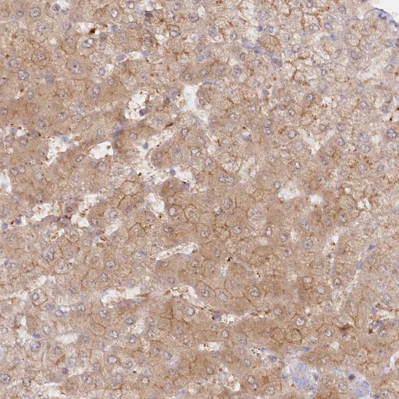 Staining of human liver shows moderate cytoplasmic and membranous positivity in hepatocytes.
