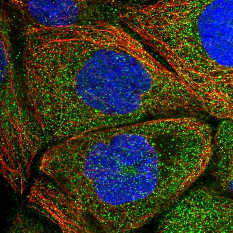 Staining of human cell line A-431 shows localization to cytosol.