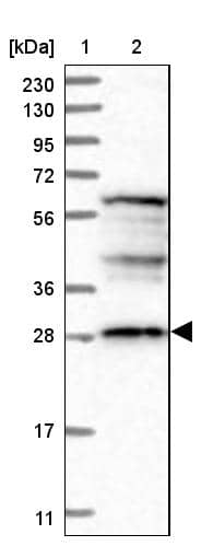 Lane 1: Marker [kDa] 230, 130, 95, 72, 56, 36, 28, 17, 11Lane 2: Human cell line RT-4