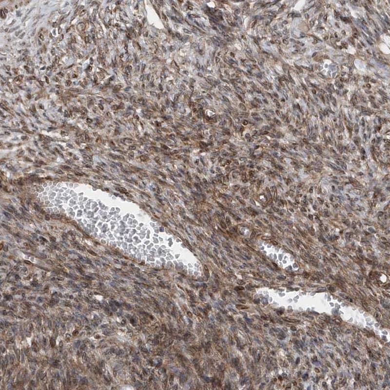Immunohistochemistry-Paraffin MCC Antibody - BSA Free