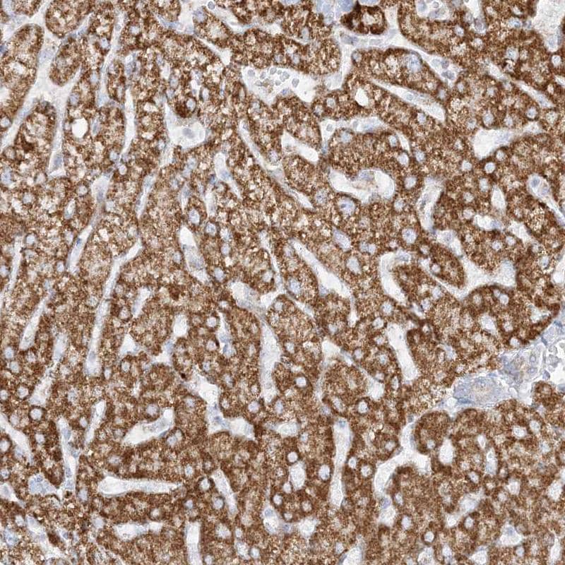 Staining of human liver shows strong granular cytoplasmic positivity in hepatocytes.