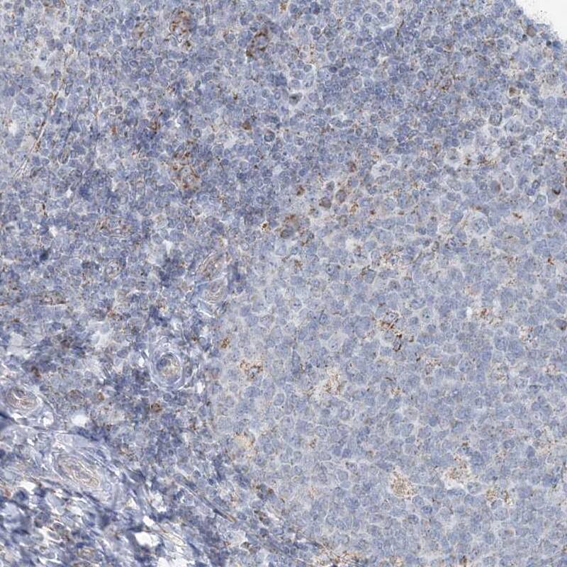 Staining of human tonsil shows low expression as expected.