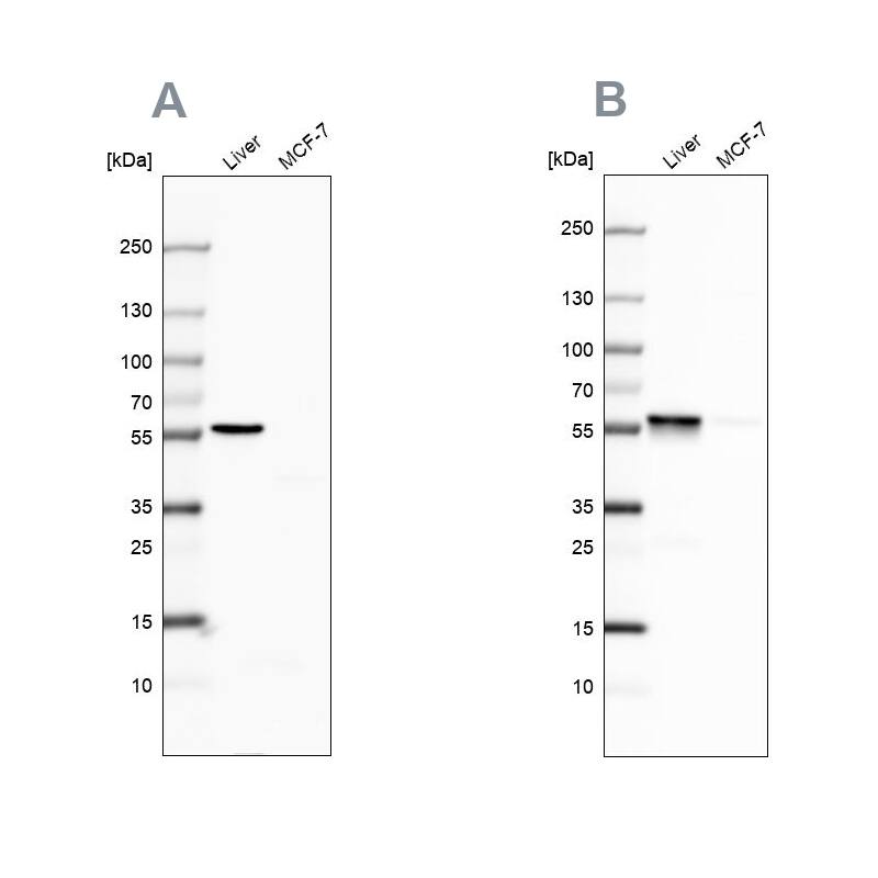 <b>Independent Antibodies Validation. </b>Analysis using Anti-PCCB antibody NBP1-85887 (A) shows similar pattern to independent antibody NBP1-85886 (B).