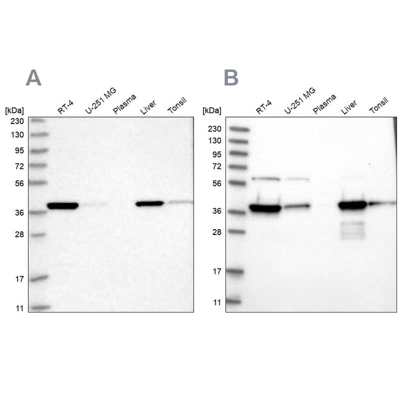 <b>Independent Antibodies Validation. </b>Analysis using Anti-HIBCH antibody NBP1-85891 (A) shows similar pattern to independent antibody NBP2-32669 (B).