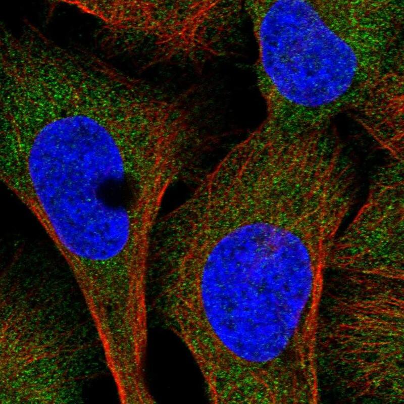 Staining of human cell line U-2 OS shows localization to cytosol.