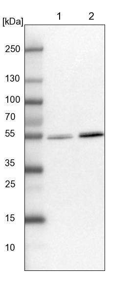 Lane 1: NIH-3T3 cell lysate (Mouse embryonic fibroblast cells)Lane 2: NBT-II cell lysate (Rat Wistar bladder tumour cells)
