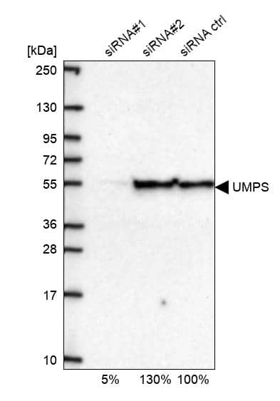 <b>Genetic Strategies Validation. </b>Analysis in U2OS cells transfected with control siRNA, target specific siRNA probe #1 and #2, using Anti-UMPS antibody. Remaining relative intensity is presented.