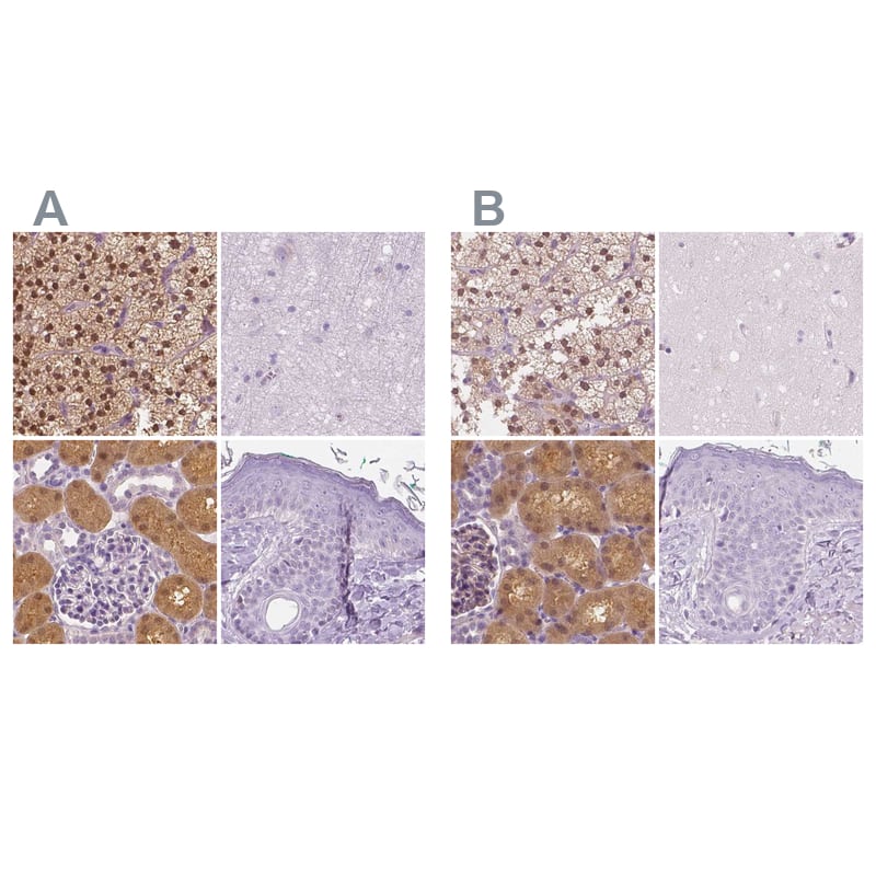 <b>Independent Antibodies Validation. </b>Staining of human adrenal gland, cerebral cortex, kidney and skin using Anti-GALM antibody NBP1-85906 (A) shows similar protein distribution across tissues to independent antibody NBP2-38252 (B).
