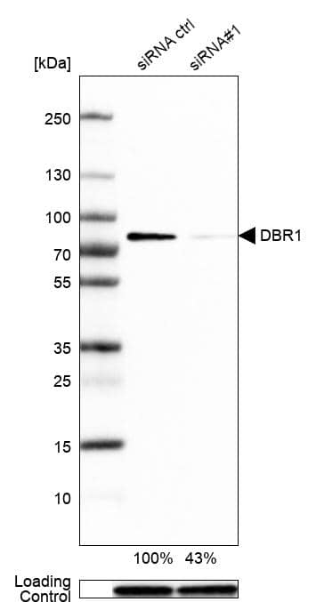 Analysis in A-431 cells transfected with control siRNA, target specific siRNA probe #1, using Anti-DBR1 antibody. Remaining relative intensity is presented. Loading control: Anti-GAPDH.