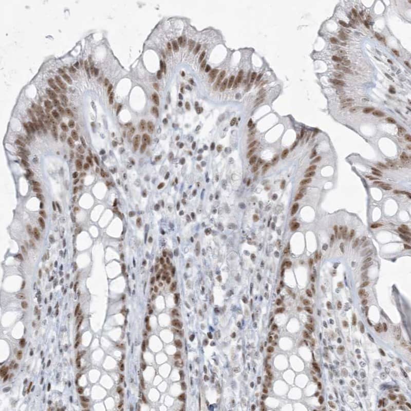 Immunohistochemistry-Paraffin ZNF787 Antibody - BSA Free