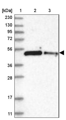 Western Blot ZNF787 Antibody - BSA Free