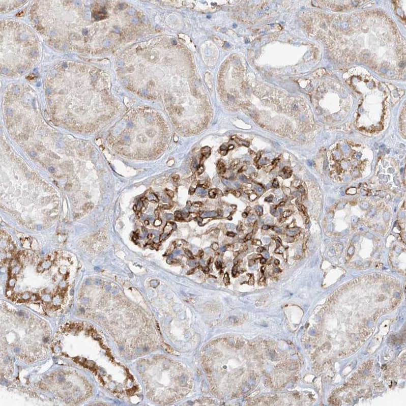 Staining of human kidney shows strong membranous positivity in cells in glomeruli.