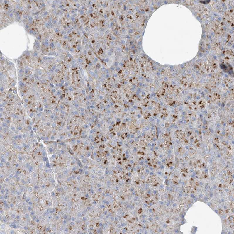 Staining of human pancreas shows strong cytoplasmic granular positivity in exocrine glandular cells.
