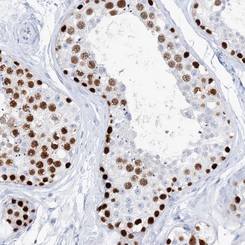 Staining of human testis shows high expression.