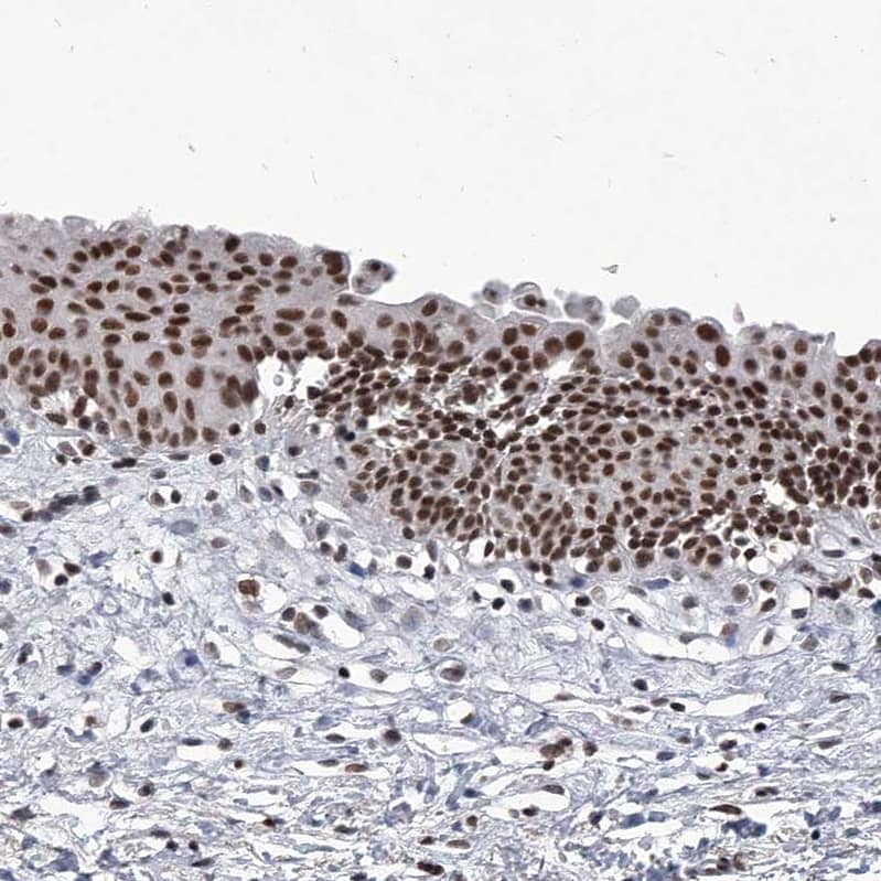 Staining of human urinary bladder shows strong nuclear positivity in urothelial cells.