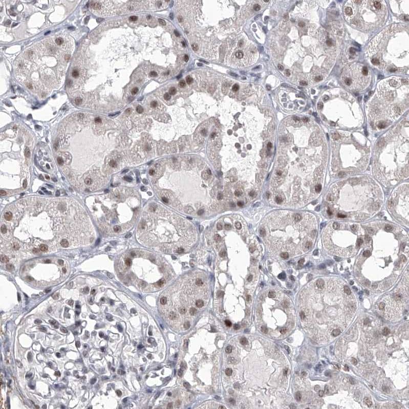 Staining of human kidney shows moderate nuclear positivity in cells in tubules.