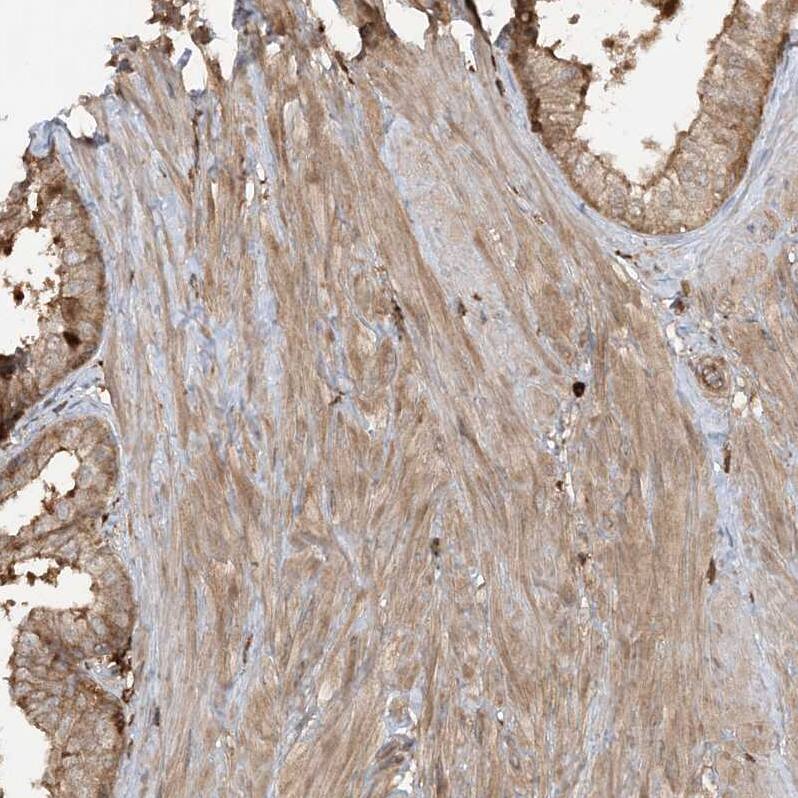 Staining of human prostate shows moderate cytoplasmic positivity in smooth muscle cells.