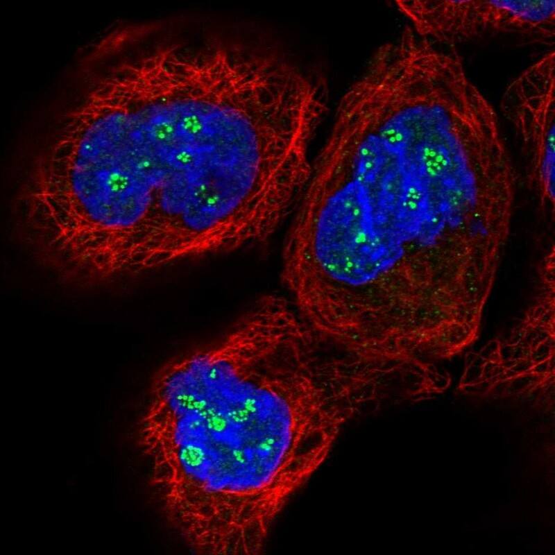 Staining of human cell line A-431 shows localization to nucleoli fibrillar center.
