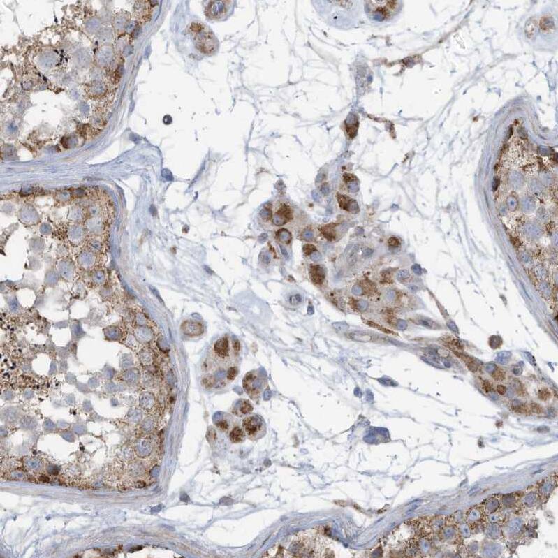 Immunohistochemistry-Paraffin GTPBP2 Antibody - BSA Free