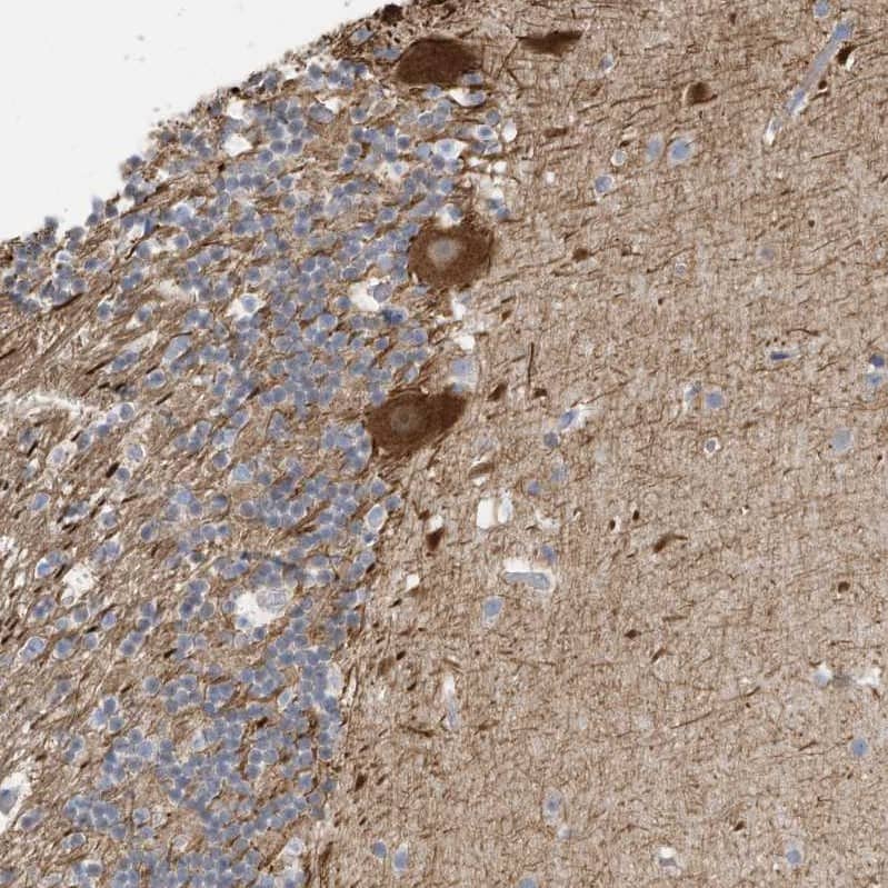Staining of human cerebellum shows strong cytoplasmic positivity in purkinje cells.