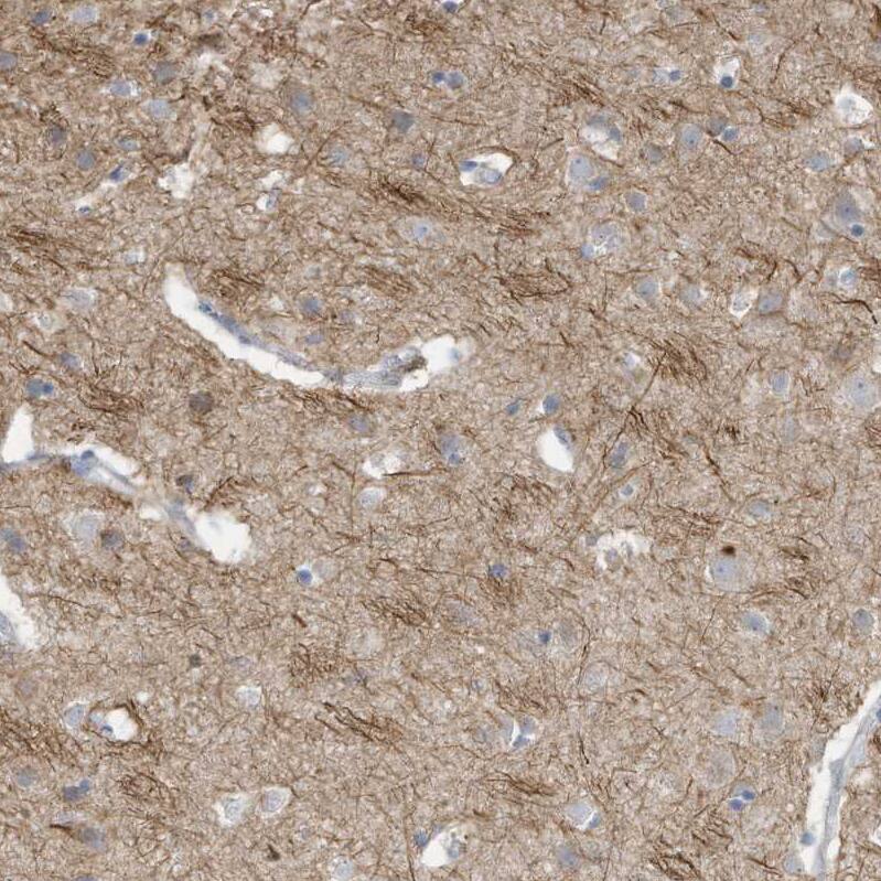 Staining of human cerebral cortex shows moderate to strong cytoplasmic positivity in neuropil.