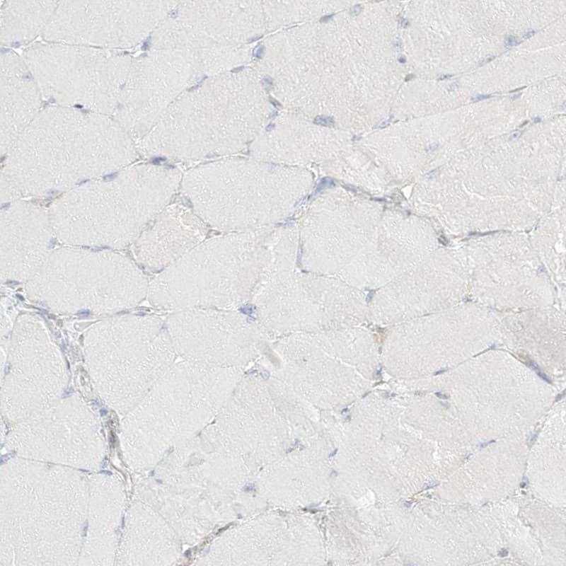 Staining of human skeletal muscle shows low expression as expected.