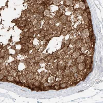 Staining of human testis.
