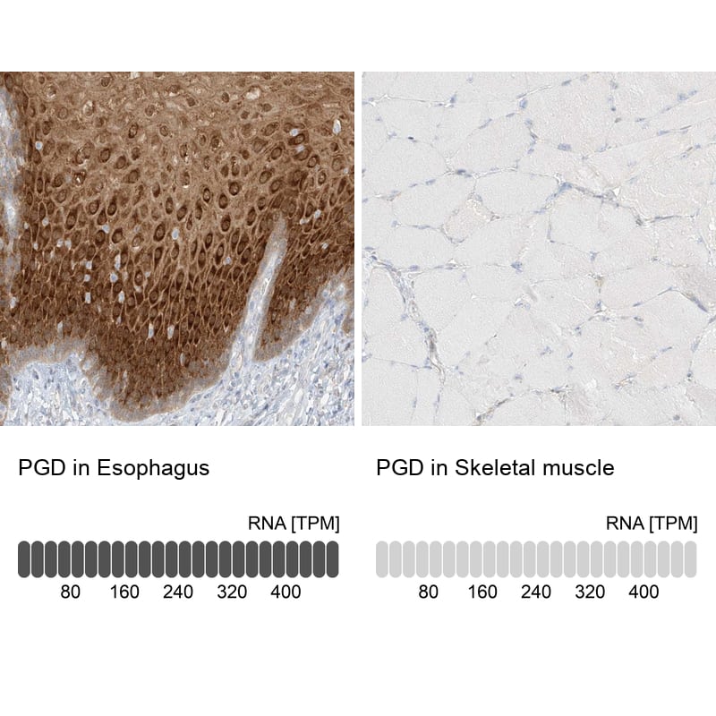 <b>Orthogonal Strategies Validation. </b>Analysis in human esophagus and skeletal muscle tissues.
