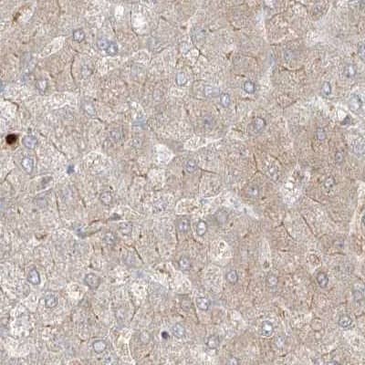Staining of human liver.