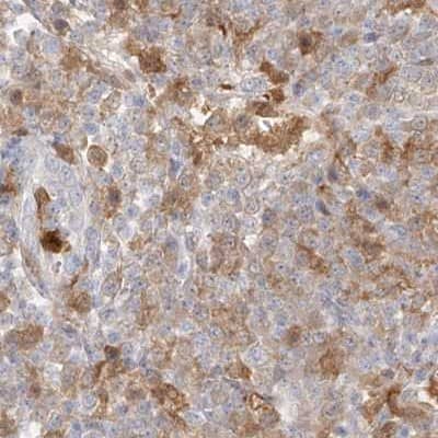 Staining of human lymph node.