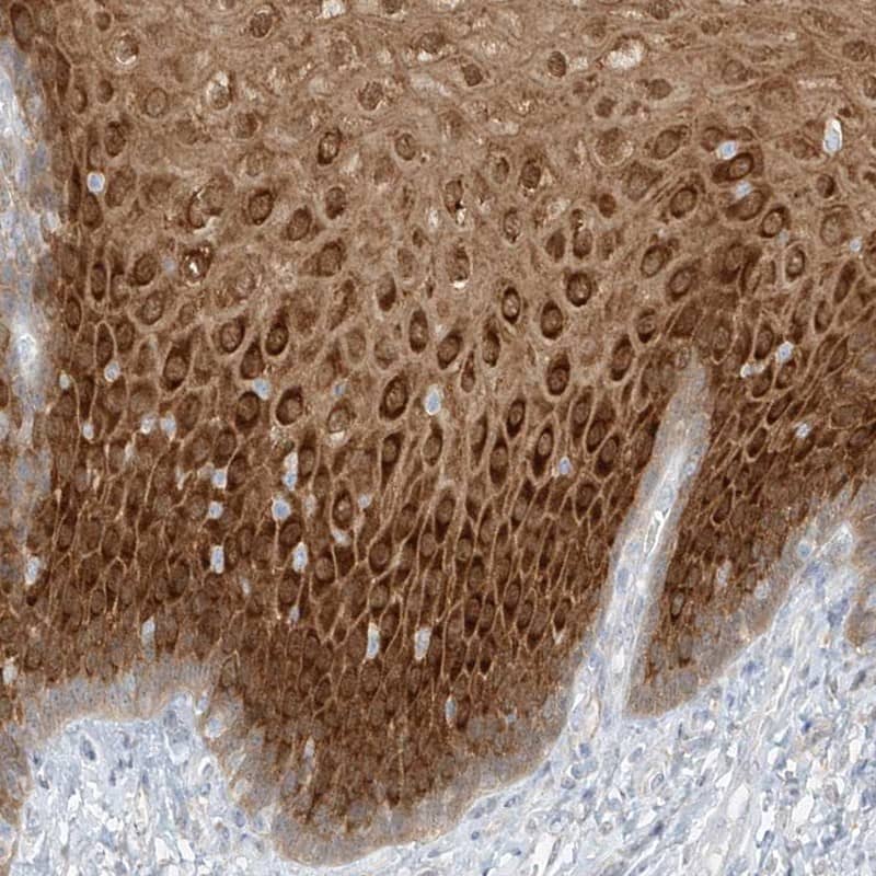 Staining of human esophagus shows high expression.