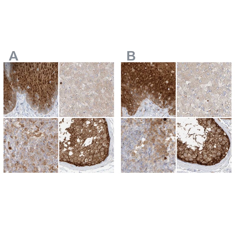 <b>Orthogonal Strategies Validation. </b>Staining of human esophagus, liver, lymph node and testis HPA031314 (A) shows similar protein distribution across tissues to independent antibody HPA031315 (B).