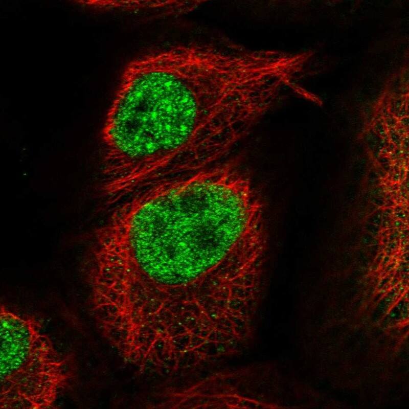 Staining of human cell line A-431 shows localization to nucleoplasm & nuclear bodies.