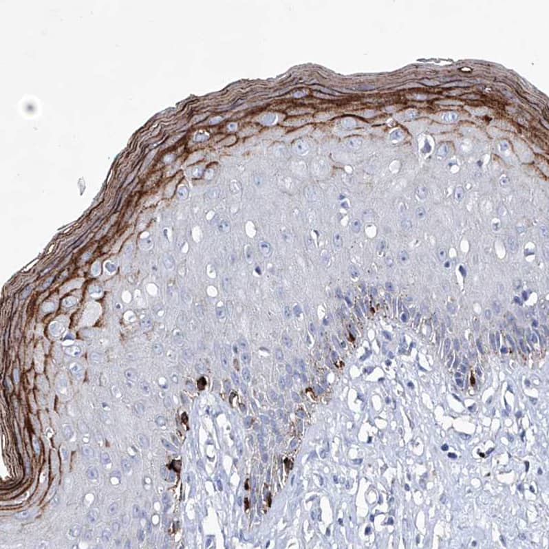 Staining of human skin shows strong cytoplasmic positivity in melanocytes.