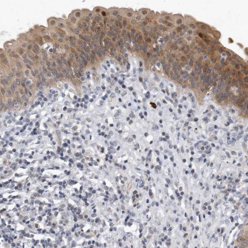 Staining of human urinary bladder shows moderate cytoplasmic positivity in urothelial cells.