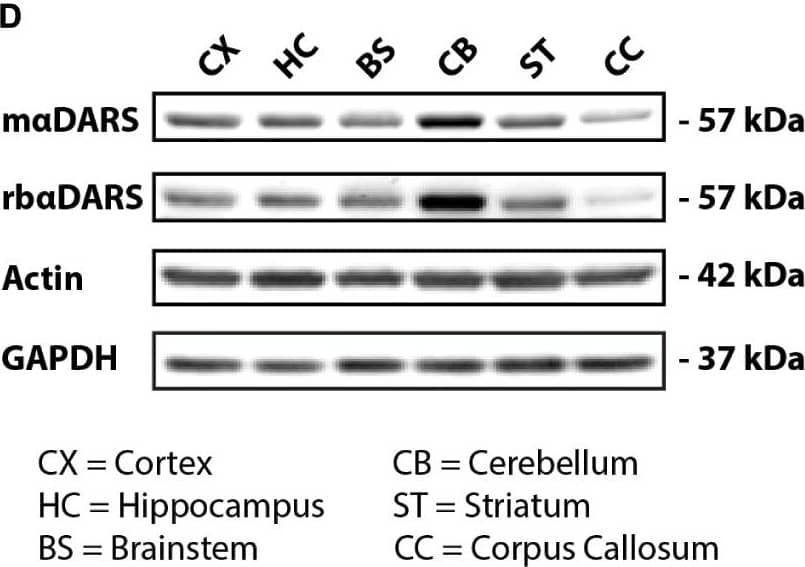DARS expression in the adult human brain. (A,B) Levels of DARS(A) and DARS2(B) mRNA across different brain regions [CX, motor cortex; HC, hippocampus; BS, brainstem (pons); CB, cerebellum; ST, striatum; CC, corpus callosum] determined by qRT-PCR. DARS and DARS2 mRNA were normalized to the housekeeping gene  beta -Actin (n = 5). (C) Western-blot detection of DARS in lysates from HEK 293 cells ectopically expressing human DARS including an N-terminal FLAG-HA-tag or a control plasmid. DARS protein was detected with a monoclonal mouse antibody from SantaCruz (m alpha DARS), or a polyclonal rabbit antibody from Novus Biologicals (rb alpha DARS), or an HA antibody.  beta -Actin served as internal standard. (D) Representative Western-blot depicting the expression of DARS,  beta -Actin, and GAPDH across different brain regions. (E) Levels of DARS protein (detected with m alpha DARS) normalized to  beta -Actin (n = 5). Data represent mean +/- SEM (∗p < 0.05, ∗∗p < 0.01, ∗∗∗p < 0.001; one-way ANOVA). Image collected and cropped by CiteAb from the following open publication (//pubmed.ncbi.nlm.nih.gov/29615866), licensed under a CC-BY license. Not internally tested by Novus Biologicals.