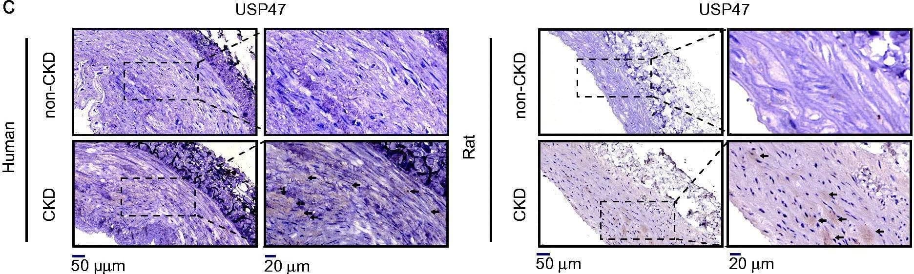 Increased expression of USP47 in CKD vascular calcification in vivo and vitro. (a) The expression levels of USP47 as assayed by immunoblotting in a high phosphorus environment for 72 h in RASMCs. The Student’s unpaired t-test analysis was used, *p < 0.05. n = 3 for each group. (b) Alizarin red staining of CKD rat abdominal aortas and CKD patient radial arteries. (c) Representative immunohistochemical staining of USP47 in aortas of CKD rats and in the radial arteries of CKD patients. Arrows mark USP47 positive areas. The scale bar corresponds to sizes from 20 to 50 μm. Image collected and cropped by CiteAb from the following open publication (//pubmed.ncbi.nlm.nih.gov/35509185), licensed under a CC-BY license. Not internally tested by Novus Biologicals.
