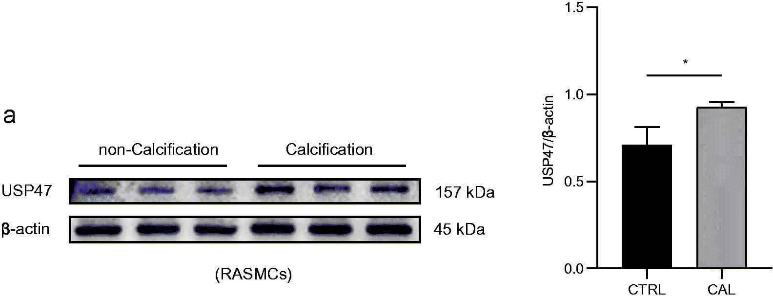 Increased expression of USP47 in CKD vascular calcification in vivo and vitro. (a) The expression levels of USP47 as assayed by immunoblotting in a high phosphorus environment for 72 h in RASMCs. The Student’s unpaired t-test analysis was used, *p < 0.05. n = 3 for each group. (b) Alizarin red staining of CKD rat abdominal aortas and CKD patient radial arteries. (c) Representative immunohistochemical staining of USP47 in aortas of CKD rats and in the radial arteries of CKD patients. Arrows mark USP47 positive areas. The scale bar corresponds to sizes from 20 to 50 μm. Image collected and cropped by CiteAb from the following open publication (//pubmed.ncbi.nlm.nih.gov/35509185), licensed under a CC-BY license. Not internally tested by Novus Biologicals.