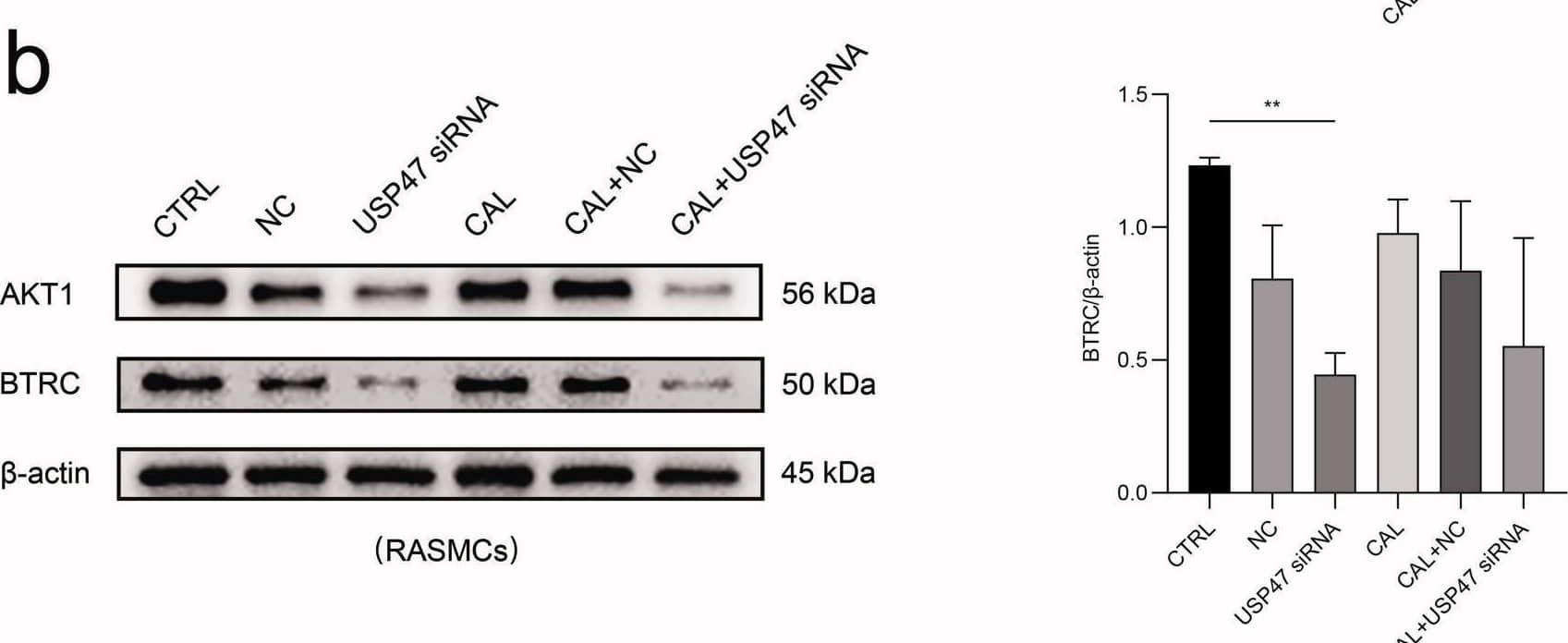 Bioinformatics analysis. (a) The protein-protein interactions network enrichment analysis. (b) The expression levels of BTRC and AKT1 in USP47 siRNA RASMCs according to immunoblotting in high phosphorus environment for 72 h. One-way analysis of variance (ANOVA) was used, *p < 0.05, **p < 0.01. (c) The levels of FGF23, Klotho (KL), and MGP in USP47 siRNA-transfected cells according to real-time PCR in high phosphorus environment for 72 h. Image collected and cropped by CiteAb from the following open publication (//pubmed.ncbi.nlm.nih.gov/35509185), licensed under a CC-BY license. Not internally tested by Novus Biologicals.