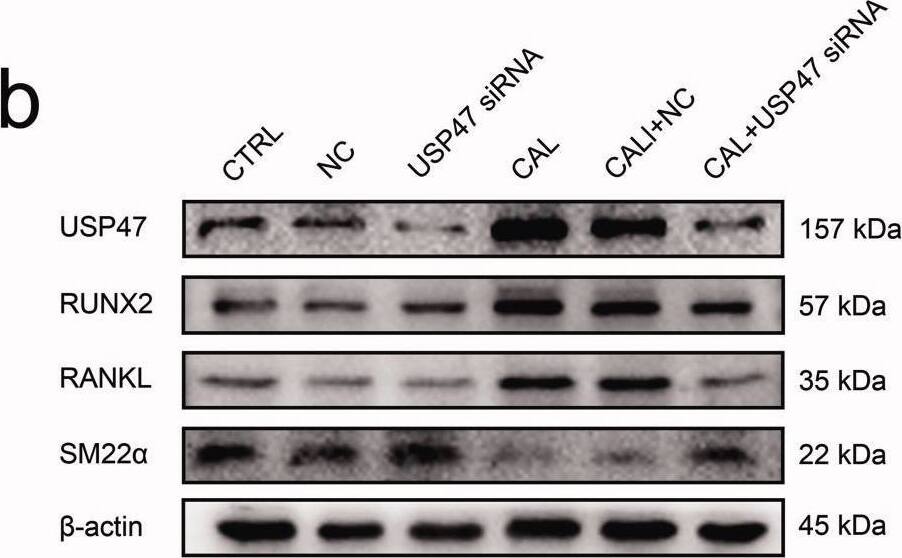 The impact of calcification with knockdown of USP47 proteins in RASMCs. (a) The level of calcification according to real-time PCR in the control group (CTRL), the negative control group (NC), and the USP47 siRNA-transfected group (USP47 siRNA) with or without calcification (CAL). One-way analysis of variance (ANOVA) was used, *p < 0.05, **p < 0.01. (b) The expression levels of USP47, RUNX2, RANKL and SM22 alpha  in USP47 siRNA RASMCs according to immunoblotting. (c) Von kossa staining of USP47 siRNA RASMCs cultured in a high phosphorus environment for 72 h. The scale bar represents 50 μm. Image collected and cropped by CiteAb from the following open publication (//pubmed.ncbi.nlm.nih.gov/35509185), licensed under a CC-BY license. Not internally tested by Novus Biologicals.
