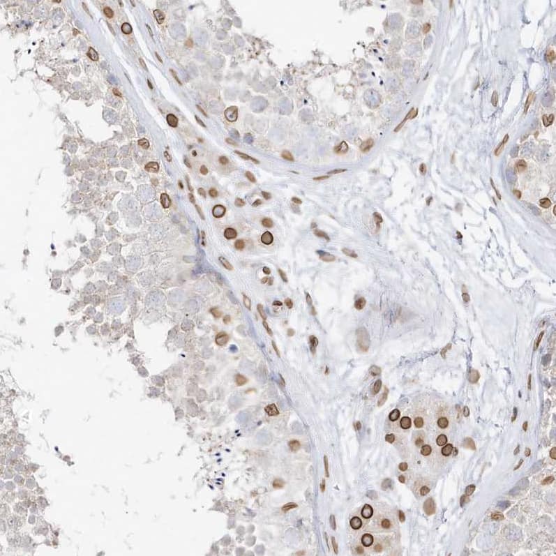 Staining of human testis shows strong positivity in nuclear membrane in Leydig cells and a subset of cells in seminiferous ducts.