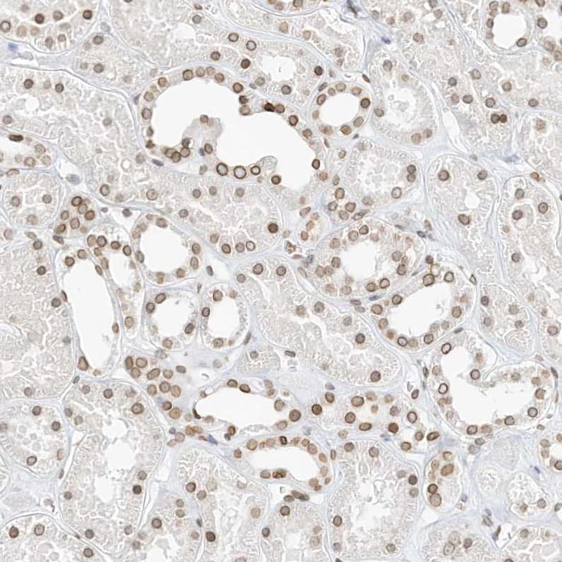 Staining of human kidney shows moderate positivity in nuclear membrane in cells in tubules.
