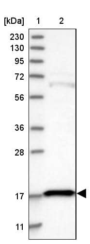 Lane 1: Marker [kDa] 230, 130, 95, 72, 56, 36, 28, 17, 11Lane 2: Human cell line RT-4
