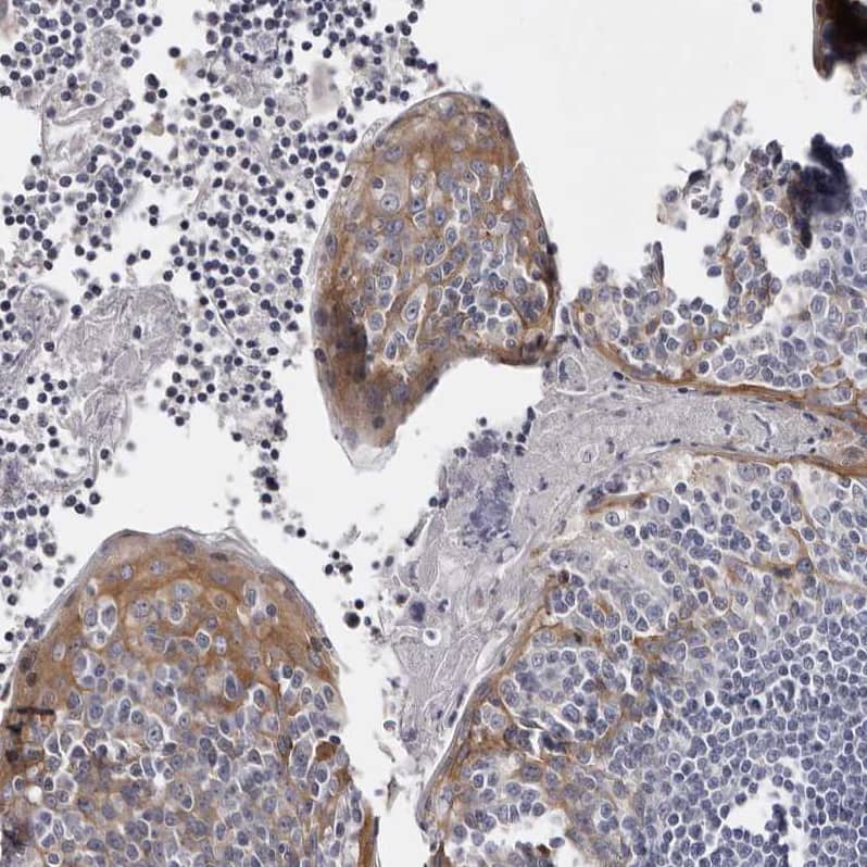 Immunohistochemistry-Paraffin LAD1 Antibody - BSA Free
