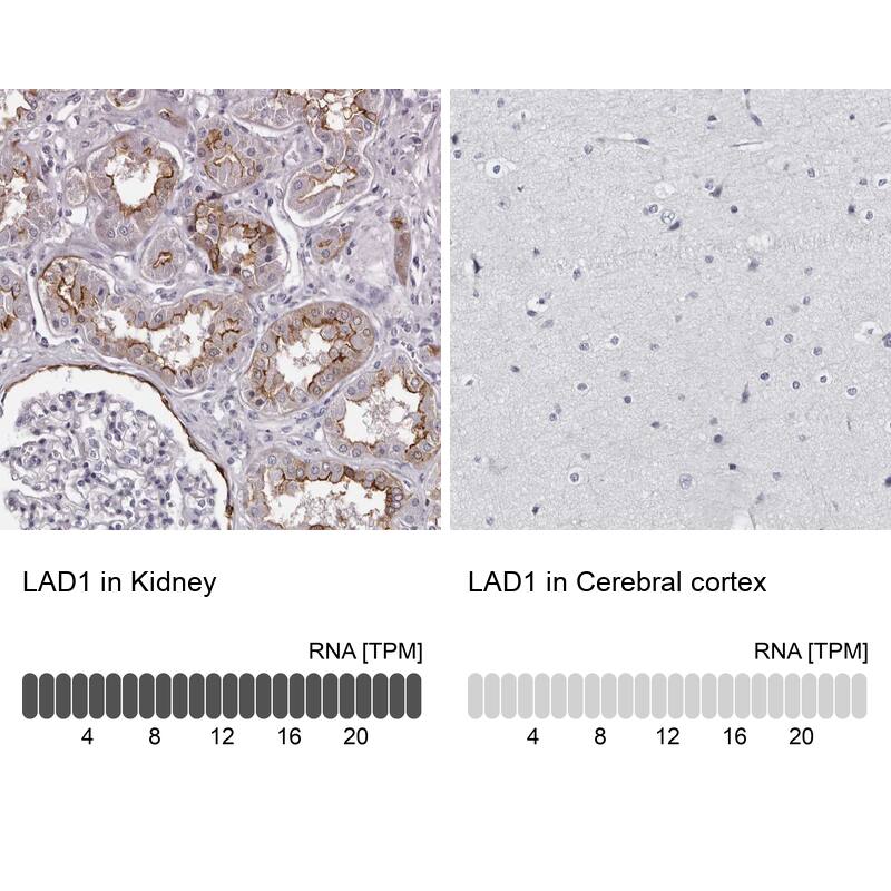 Immunohistochemistry-Paraffin LAD1 Antibody - BSA Free