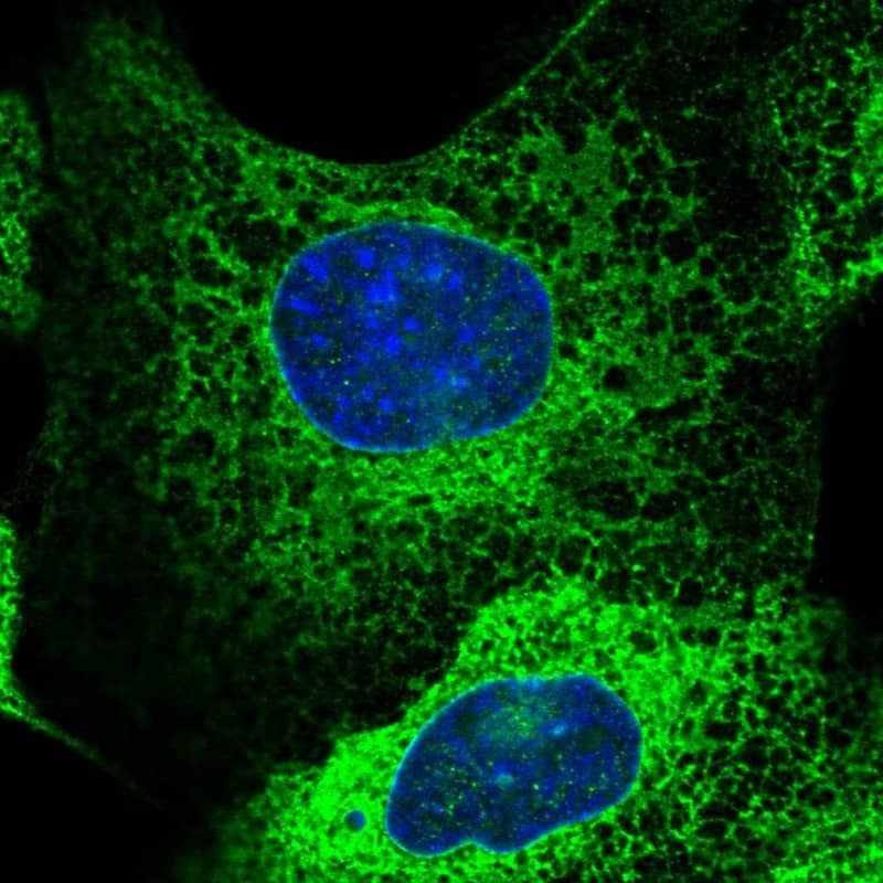 Staining of human cell line A-431 shows localization to endoplasmic reticulum.